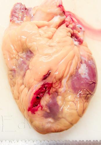 tamponade-1.jpg