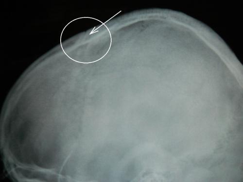post-5216-0-39524600-1409911100_thumb.jpg
